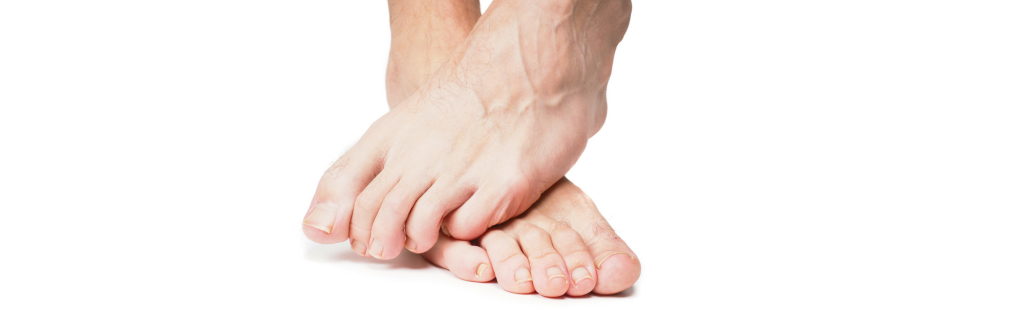 Spasms, Cramps, and Charley Horses…..Oh My! Foot Cramp 1 spasms, cramps, and charley horses…..oh my! uncategorized