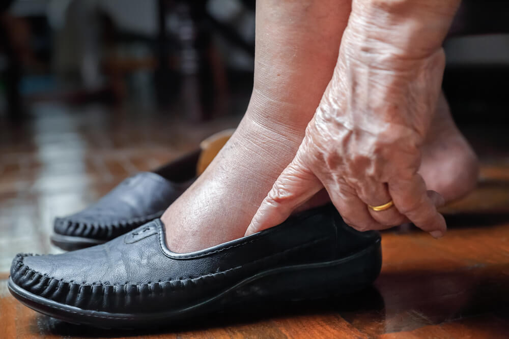 Where to Find Lymphedema Therapy in Havelock, North Carolin Lymphedema Therapy lymphedema therapy