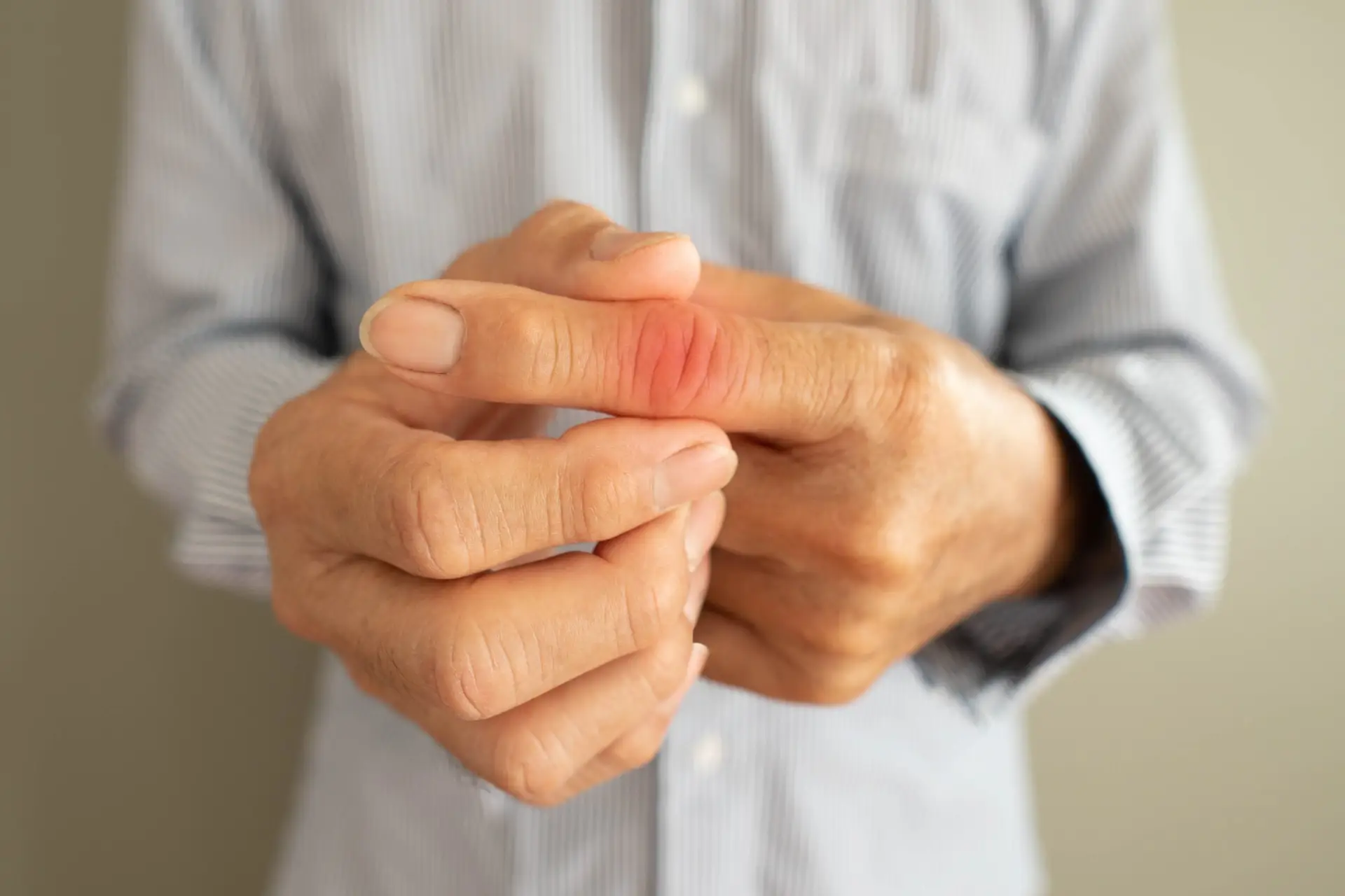 Physical Therapy for Trigger Finger