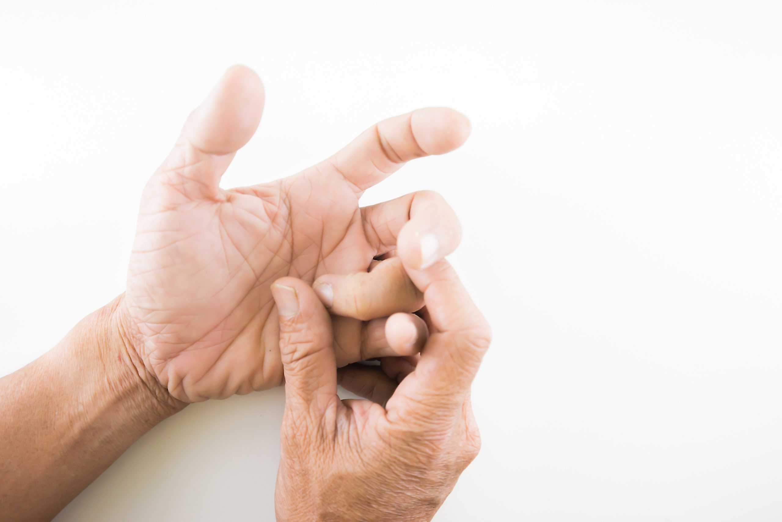 Can I Treat Trigger Finger With Exercises?